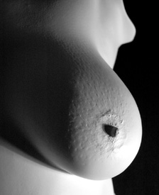 The detail of a breast cast